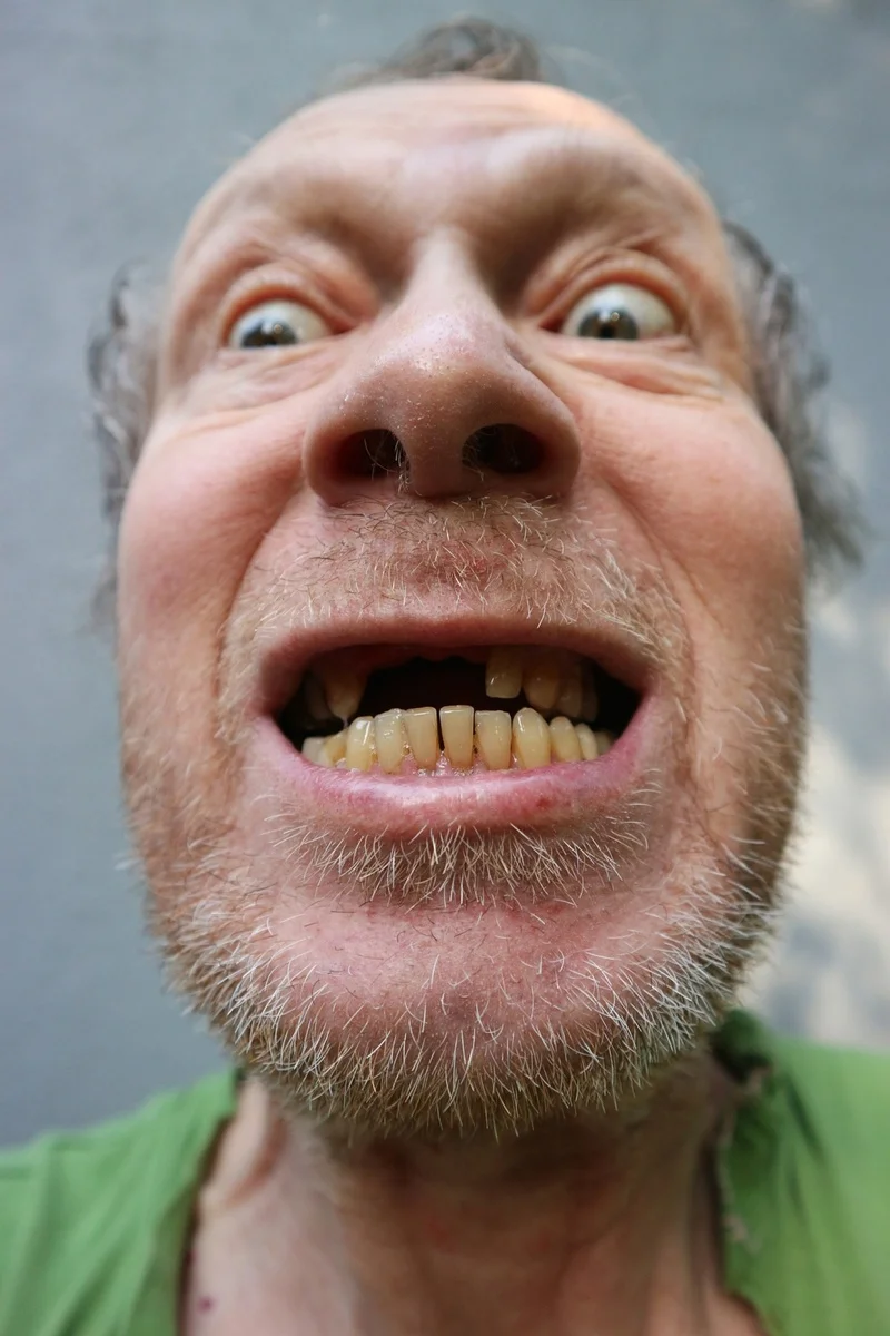 es.net%2Fpictures%2F170000%2Fvelka%2Fmissing-teeth.webp